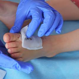 Lower Limb Wound Care